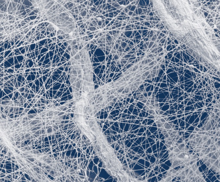 Ultra-Web and Fibra-Web filter cartridges close up | AST CAnada